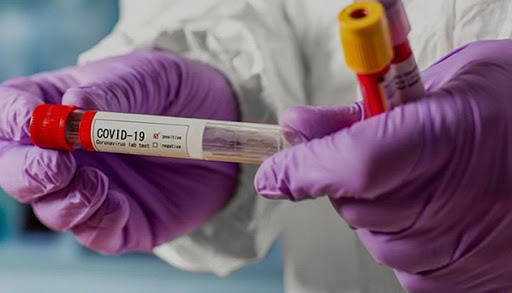 В Запорожской области выявили новые случаи заражения COVID-19 (СТАТИСТИКА)