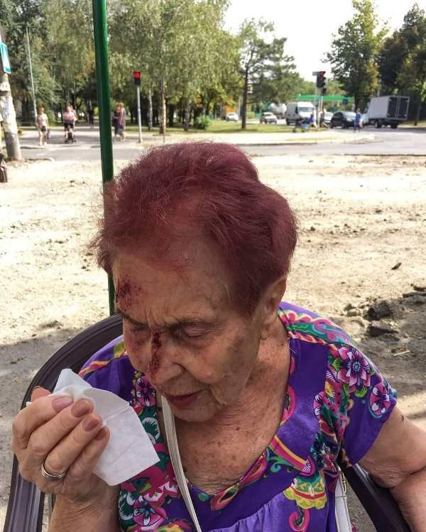 В Запорожье женщина из-за халатности рабочих разбила голову (ФОТО) 5 В Запорожье женщина из-за халатности рабочих разбила голову (ФОТО)
